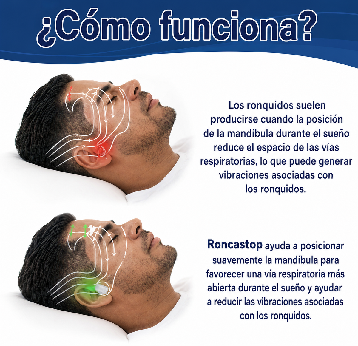 Boquilla Antironquidos RoncaStop
